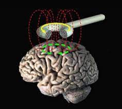 Transcranial Magnetic Stimulation (TBS) – A new way to reduce Nicotine addiction