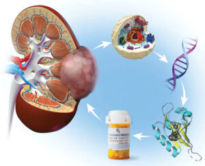 BELZUTIFAN – A new drug developed to fight against Renal cell carcinoma